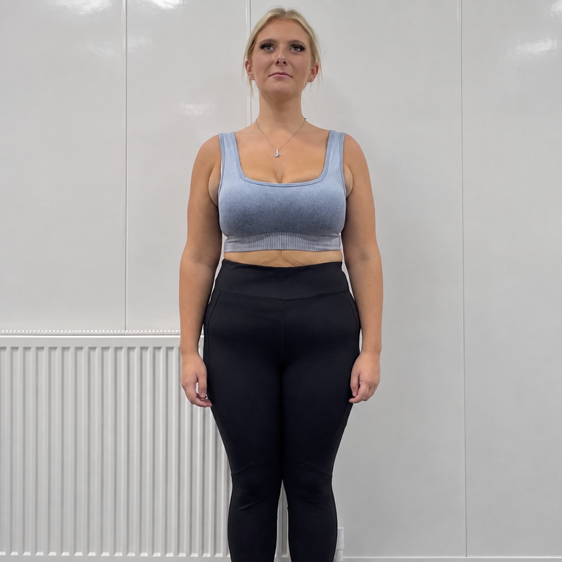 After transformation for Zoe
